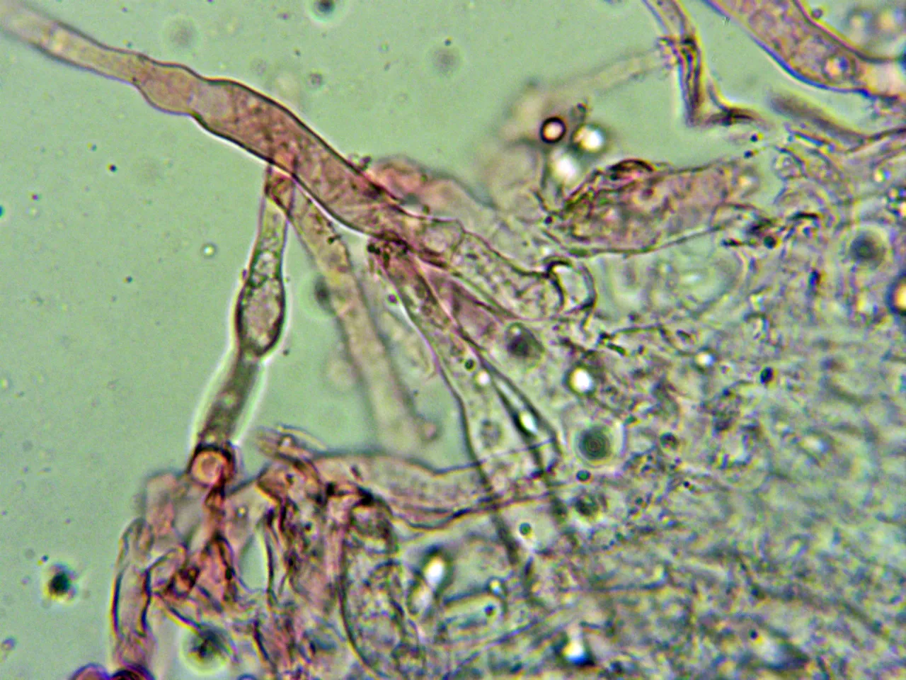 Microscopía de Marasmiellus candidus - 10 - Pileocistidios